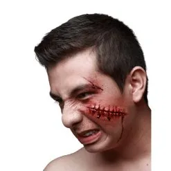 Blessure Points De Sutures En Latex