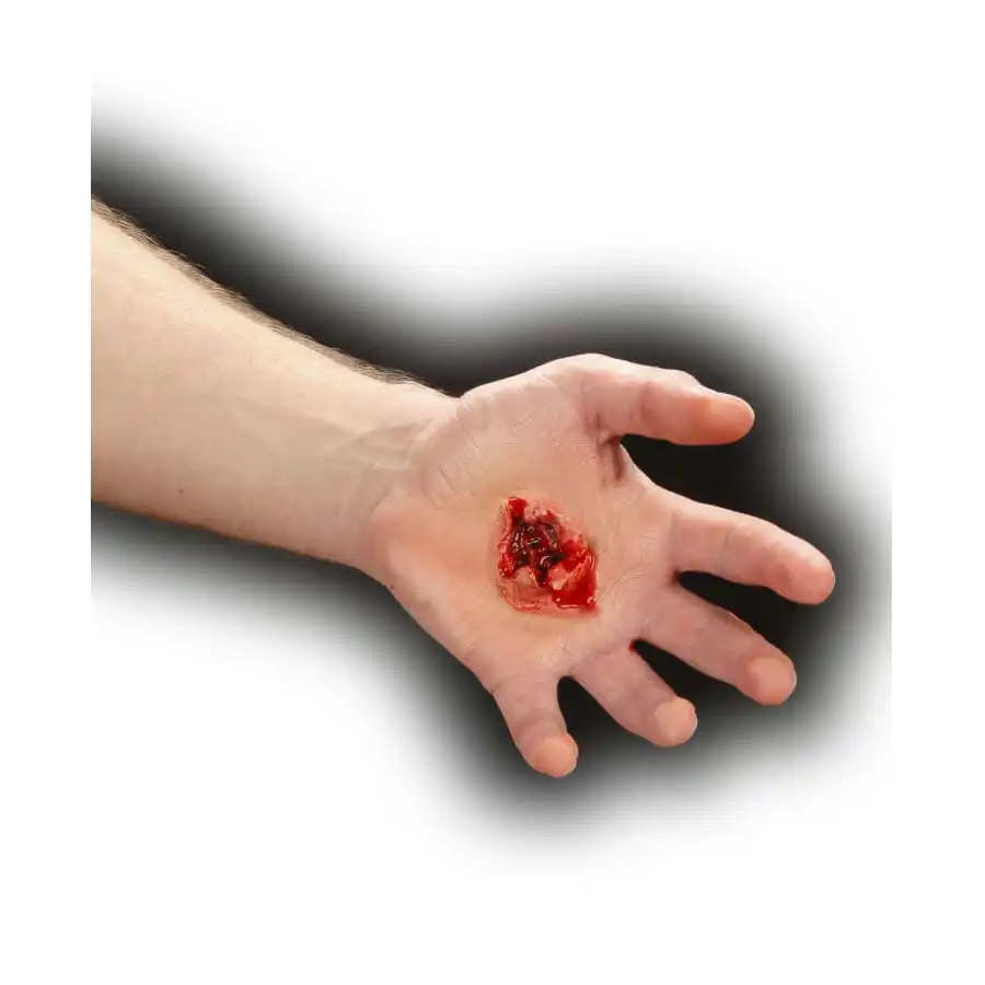 Plaie Infectée 2 Plaie Infectée – Image 2